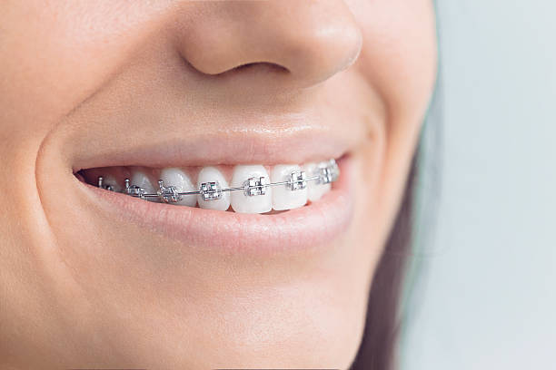 Best Tooth Extraction  in Roanoke, AL